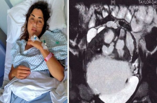 Το σεξ με το αγόρι της έσωσε τη ζωή – Τι ανακάλυψε ο γιατρός που την εξέτασε