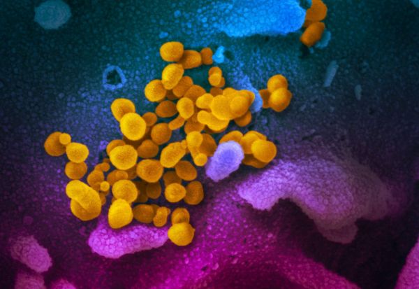 Μετάλλαξη Δέλτα : Ποια εξελικτικά πλεονεκτήματα οδήγησαν στην επικράτησή του