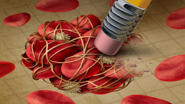 Εξιτήριο νωρίτερα με αντιθρομβωτικό για ασθενείς COVID μέτριας βαρύτητας