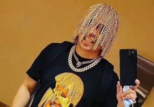 Ράπερ έκανε χειρουργείο για να αντικαταστήσει τα μαλλιά του με… χρυσές αλυσίδες