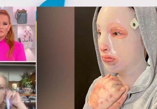 Μαρία Καλοφώνου στο Χαμογέλα και Πάλι – «Η Ιωάννα δεν θα έχει ποτέ ξανά το παλιό της πρόσωπο»