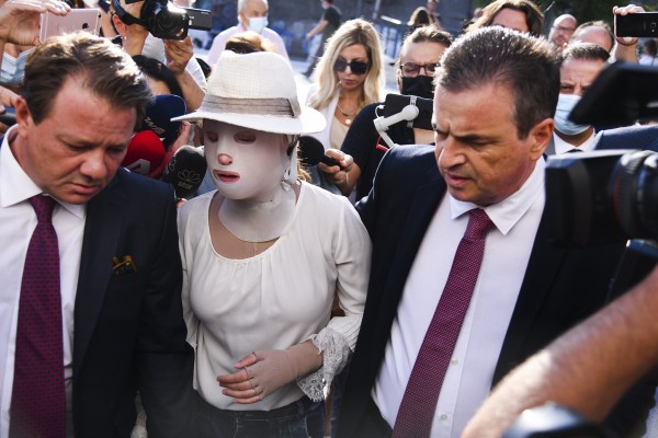 Επίθεση με βιτριόλι – Η μεγάλη μάχη της Ιωάννας για να μην χάσει το μάτι της – Τι λέει ο γιατρός της