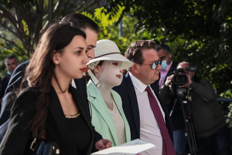 Επίθεση με βιτριόλι – Συγκλονίζει η Ιωάννα – «Έχω ψυχική και σωματική αναπηρία. Σκέφτηκα να αυτοκτονήσω»