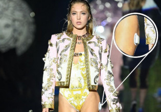 Λίλα Μος – Αποθεώθηκε για την εμφάνιση της με αντλία ινσουλίνης στην πασαρέλα