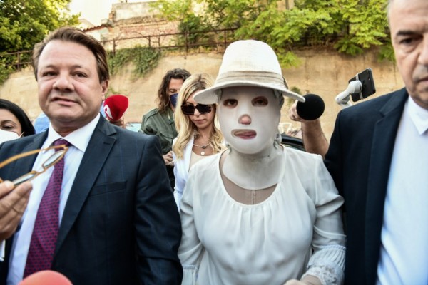 Επίθεση με βιτριόλι – Η γυναίκα που έφτιαξε τη μάσκα της Ιωάννας μιλά για το πώς κατασκευάζεται