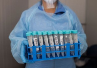 Κοροναϊός – Μείωση θνησιμότητας σε ασθενείς με ανοσοτροποιητικό φάρμακο