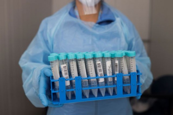 Κοροναϊός – Μείωση θνησιμότητας σε ασθενείς με ανοσοτροποιητικό φάρμακο