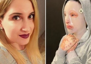 Ιωάννα Παλιοσπύρου – Τεράστιο ποσό από δωρεές μετά την επίθεση με το βιτριόλι