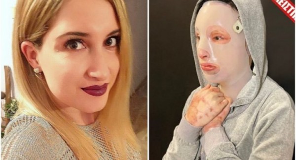 Ιωάννα Παλιοσπύρου – Τεράστιο ποσό από δωρεές μετά την επίθεση με το βιτριόλι
