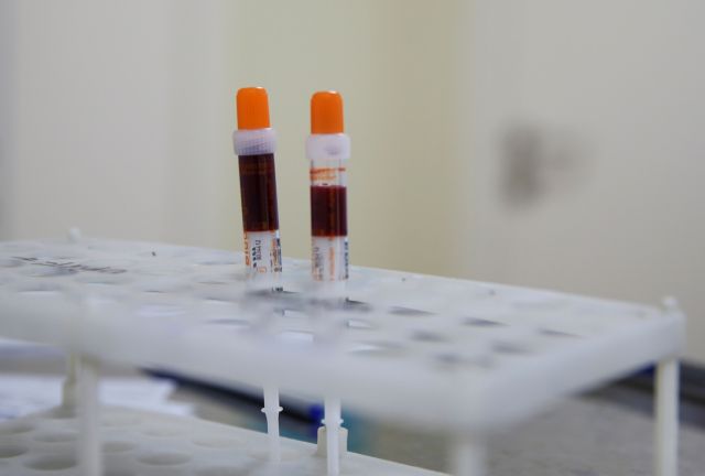 Κοροναϊός - Νέο τεστ αίματος αυτο-αντισωμάτων μπορεί να προβλέψει την πιθανότητα σοβαρής νόσησης