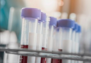 Novartis – Επενδύει στην έρευνα 9 δισ. ευρώ, 6 εκατ. στην Ελλάδα