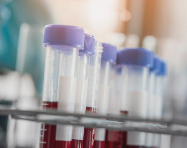 Novartis – Επενδύει στην έρευνα 9 δισ. ευρώ, 6 εκατ. στην Ελλάδα