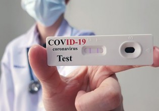 Rapid test για εργαζόμενους – Για ποια δέκα επαγγέλματα απαιτούνται δύο διαγνωστικοί έλεγχοι την εβδομάδα