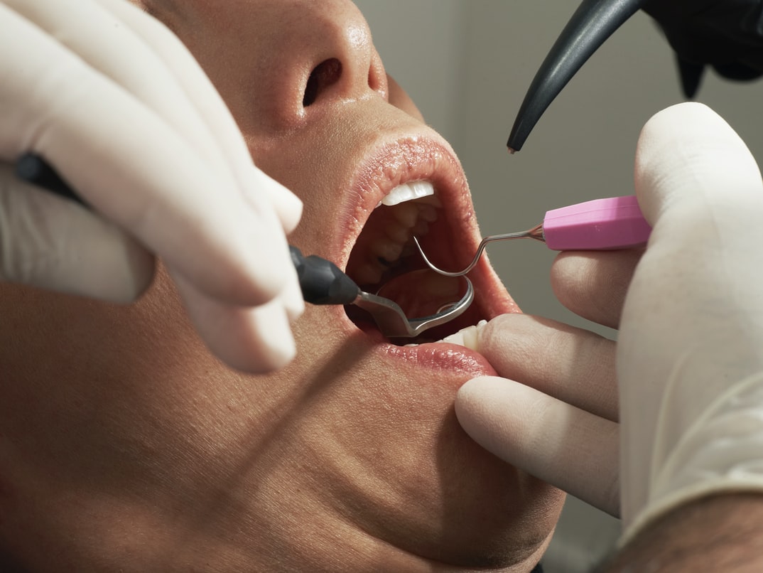 Δεν κάνουν πίσω οι οδοντίατροι για τα τα rapid test - Τι ζητούν από το υπουργείο Υγείας