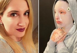 Επίθεση με βιτριόλι – Η Ιωάννα απέναντι στη γυναίκα που της κατέστρεψε τη ζωή – «Να με κοιτάξει όπως όταν μου επιτέθηκε»