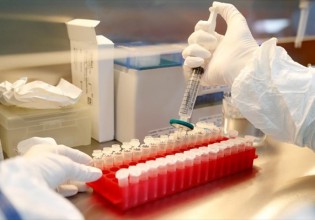 Πλεύρης – Δωρεάν τα μονοκλωνικά αντισώματα όταν θα έρθουν στην Ελλάδα