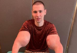 Νεαρός προσπάθησε να γίνει Ποπάι αλλά… δεν πήγε πολύ καλά αυτό