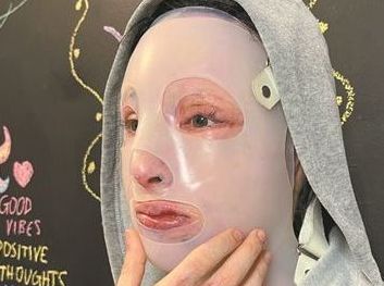 Ιωάννα Παλιοσπύρου – «Γιατί έδειξα το καμένο πρόσωπό μου – Θα πάω στο δικαστήριο χωρίς να ντρέπομαι και να φοβάμαι»