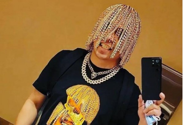 Ράπερ έκανε χειρουργείο για να αντικαταστήσει τα μαλλιά του με… χρυσές αλυσίδες