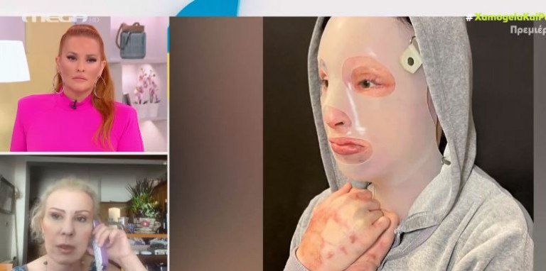 Μαρία Καλοφώνου στο Χαμογέλα και Πάλι – «Η Ιωάννα δεν θα έχει ποτέ ξανά το παλιό της πρόσωπο»