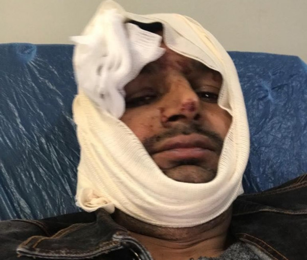 Φασιστική επίθεση – Θύματα Πακιστανοί μετανάστες – Βίντεο ντοκουμέντο