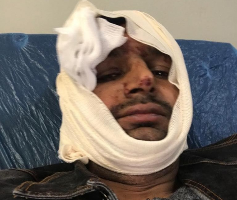 Φασιστική επίθεση – Θύματα Πακιστανοί μετανάστες – Βίντεο ντοκουμέντο