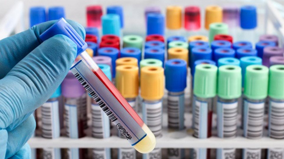 Κοροναϊός - Ο ΕΜΑ ανακοίνωσε την έναρξη αξιολόγησης του χαπιού της MSD κατά του ιού