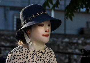 Επίθεση με βιτριόλι – «Καίνε» τη δράστρια οι καταθέσεις των γιατρών – «Διέτρεξε κίνδυνο ζωής»