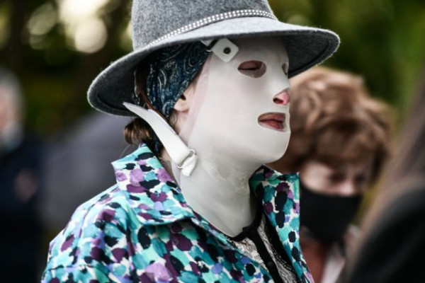 Επίθεση με βιτριόλι – «Παραμένει αμετανόητη, δεν πήρα καμία απάντηση», είπε η Ιωάννα