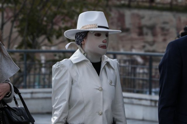 Επίθεση με βιτριόλι – Η μάχη ζωής για την Ιωάννα και η υπόσχεση σε όλες τις γυναίκες – θύματα