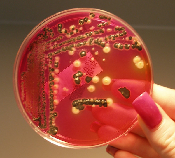 «Αντίδοτο» σε σούπερ ανθεκτικά μικρόβια το εντερικό μικροβίωμα