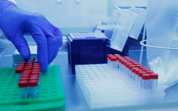 Κοροναϊός – Μονοκλωνικό αντίσωμα για τη θεραπεία ασθενών με πρoχωρημένη covid-19 ή με long covid σύνδρομο