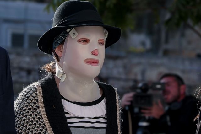 Σούρας για επίθεση με βιτριόλι – «Δεν έχω δει πιο αδίστακτη γυναίκα»