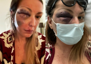 Στεφανία Τζαφέρη – Δέχτηκα απειλές ότι θα μου κλείσουν και το άλλο μάτι