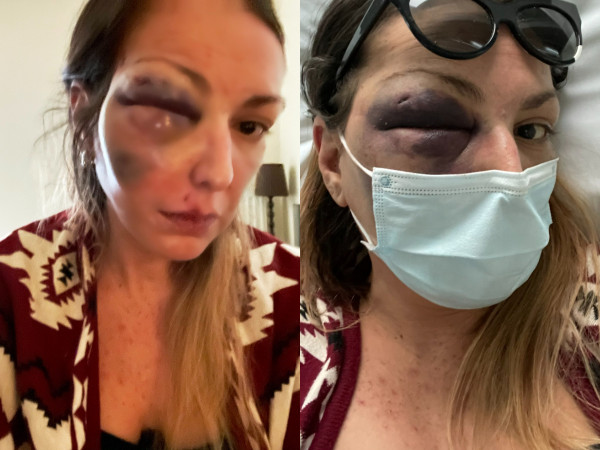 Στεφανία Τζαφέρη – Δέχτηκα απειλές ότι θα μου κλείσουν και το άλλο μάτι