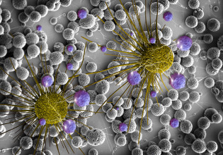 Οι βιοδείκτες προβλέπουν την έκβαση ογκολογικών θεραπειών