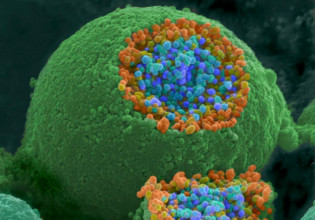 Στην εντατική με κοροναϊό, από γονίδιο υπεύθυνο για την Αλτζχάιμερ