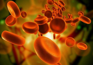 Τα εμβόλια κατά του κοροναϊού είναι λιγότερο αποτελεσματικά στους ασθενείς με πολλαπλό μυέλωμα