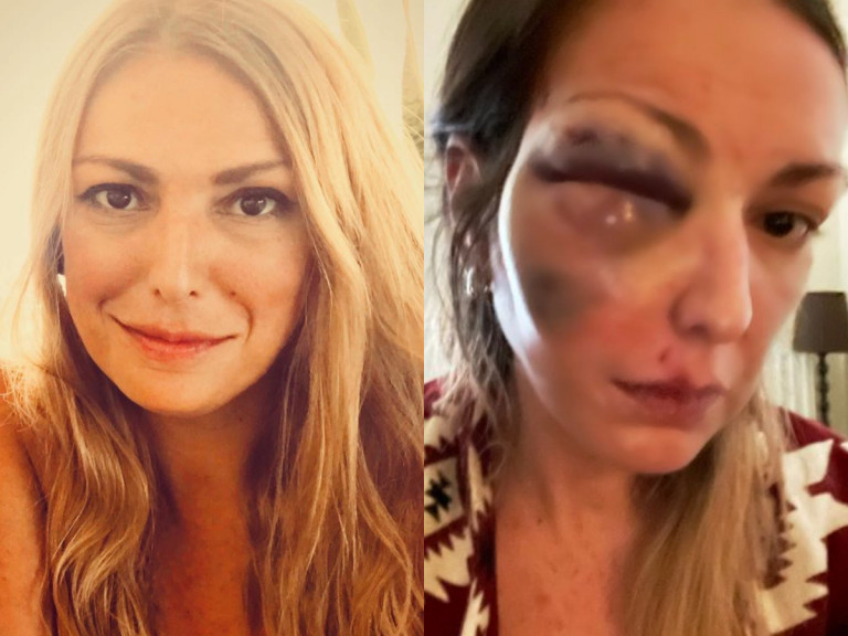 Σταυρούλα Τζαφέρη – H food blogger που έπεσε θύμα ξυλοδαρμού