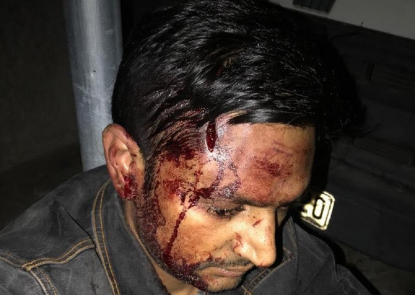 ΚΕΕΡΦΑ – Ρατσιστική επίθεση φασιστοειδών κατά τριών μεταναστών στα Καμίνια