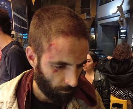Φασιστική επίθεση – Τάγμα εφόδου επιτέθηκε με κλωτσιές στο κεφάλι και στο σώμα σε μέλος του ΣΕΚ στου Ψυρρή