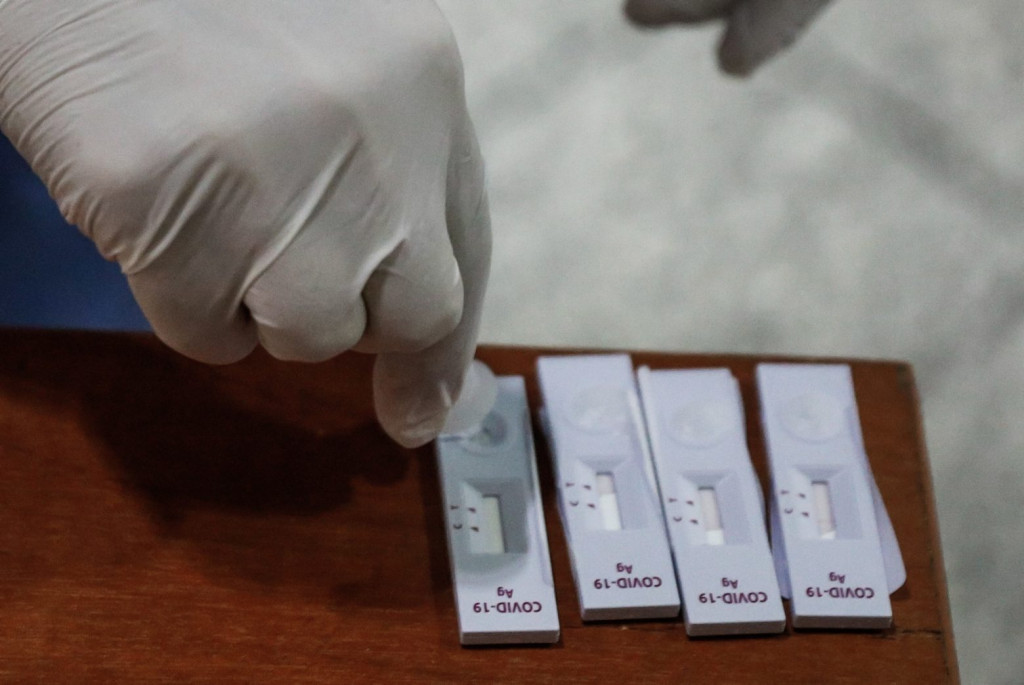 ΕΟΔΥ – Πού μπορείτε να κάνετε δωρεάν rapid test την Παρασκευή 19 Νοεμβρίου – Τι ισχύει για τους ανεμβολίαστους