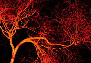 Κοροναϊός: Αποκαλύφθηκαν οι ιικές πρωτεϊνες που καταστρέφουν τα αγγεία