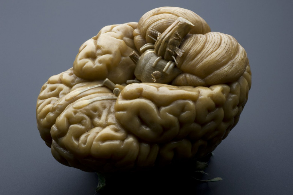 Τα αστροκύτταρα του εγκεφάλου στην υπηρεσία της τεχνητής νοημοσύνης