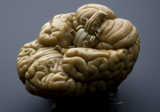 Τα αστροκύτταρα του εγκεφάλου στην υπηρεσία της τεχνητής νοημοσύνης