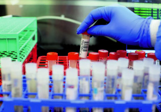 Κοροναϊός – Η Ελλάδα παρέλαβε 2.000 δόσεις μονοκλωνικών της Regeneron