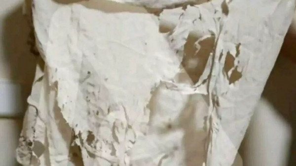 Επίθεση με βιτριόλι – Σοκάρουν οι εικόνες από τα λιωμένα ρούχα της Ιωάννας