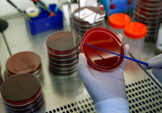 Μονοκλωνικά αντισώματα – Άνοιξε η πλατφόρμα – Πώς θα γίνονται οι αιτήσεις, σε ποιους θα δίνονται