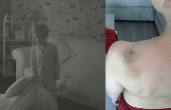 Βρετανία – Νέα ντοκουμέντα για τον 6χρονο Άρθουρ που βασανίστηκε μέχρι να πεθάνει από τους γονείς του