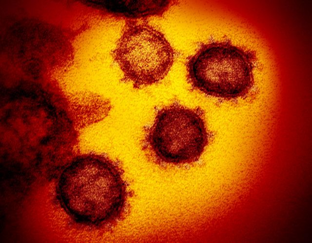 Ανησυχία Βασιλακόπουλου - Όσο αφήνουμε την πανδημία να συνεχίζεται, ο ιός θα μεταλλάσσεται